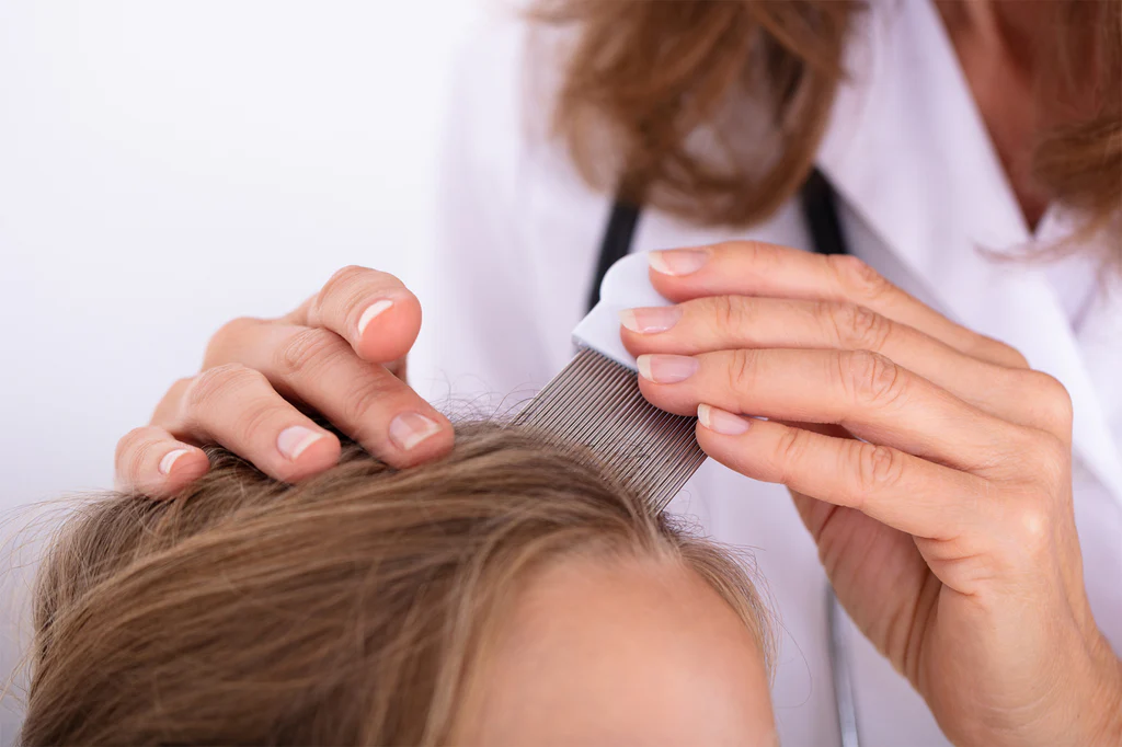 Effective Home Remedies for Lice Removal