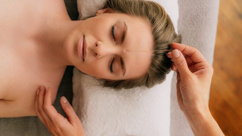 Treating Stress with Acupuncture: A Natural Solution